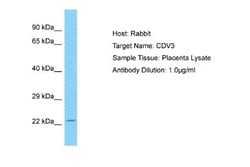 CDV3 Antibody, Novus Biologicals 100 &mu;L; Unconjugated:Antibodies, Polyclonal